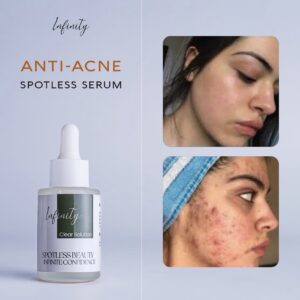 Elixir Anti-Acne Serum